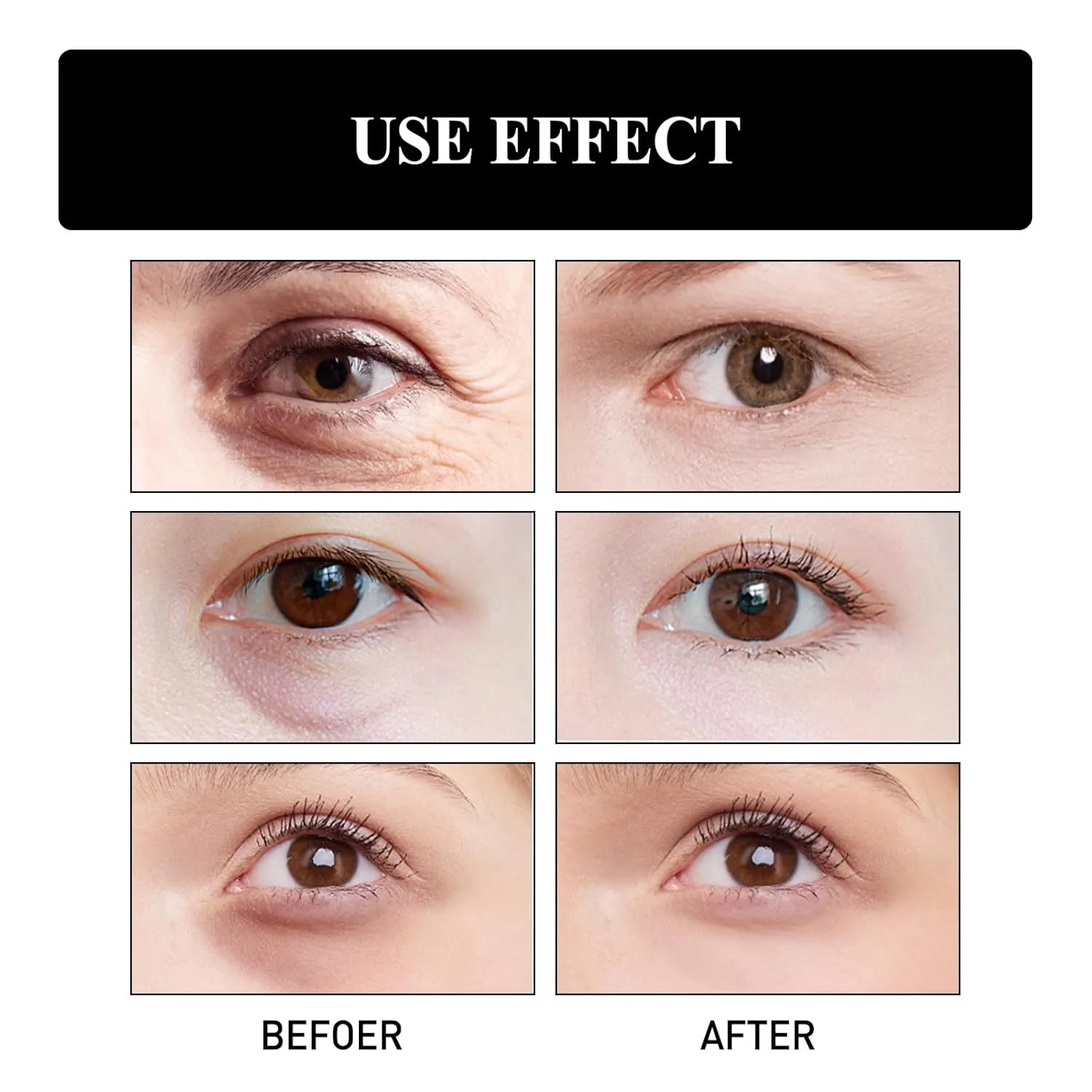 Gentian Anti-Wrinkle Eye Cream,20g Gentian Eye Cream,Hankylin Gentian Eye Cream,Gentian Eye Cream For Eye Bags,Gentian Anti Wrinkle Eye Cream,Firming (5PC)