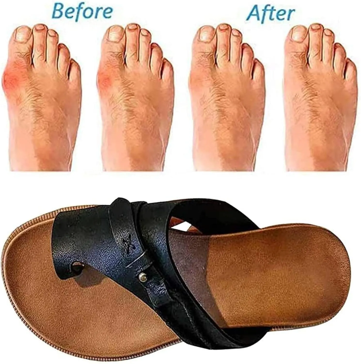 Women's Comfy Sandal Bunion Corrector Shoes Platform Soft Sole with Toe Arch Support Summer Breathable Casual Beach Travel Shoes,Brown,EU39/US7.5